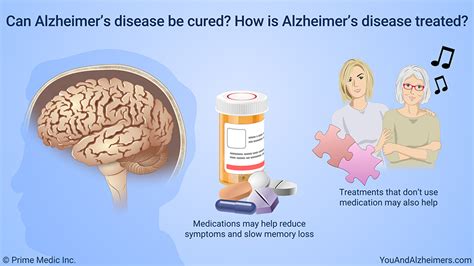 best treatment centers for alzheimer's