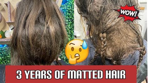 best way to get matted blood out of hair