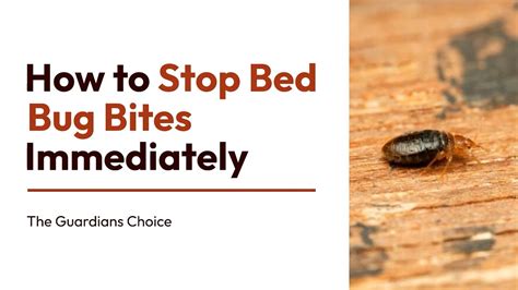 Best Way To Stop Bed Bug Bite