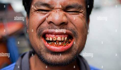 Betel Nut Chewing In The Philippines Old Man With Rotten Teeth ,