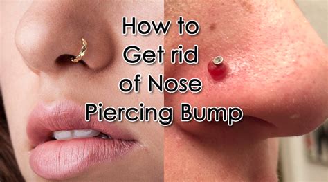 big pimple next to nose piercing