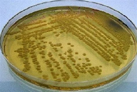 biggy agar is selective because it contains