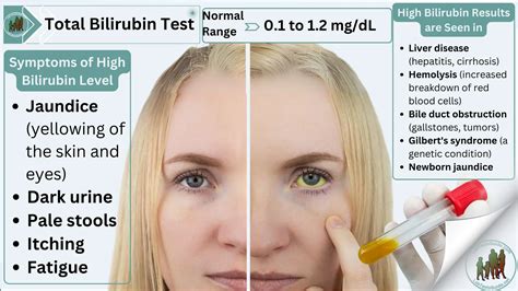 Understanding Your Health: What Does a Bili Total Blood Test Reveal?