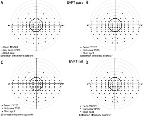 Binocular Esterman Field Test