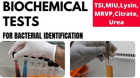 Microgen Biochemical Identification Kits Microgen