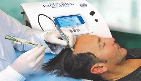Biofibre artificial Hair and baldness Remedies Medicap