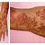 black henna tattoo allergy to hair dye