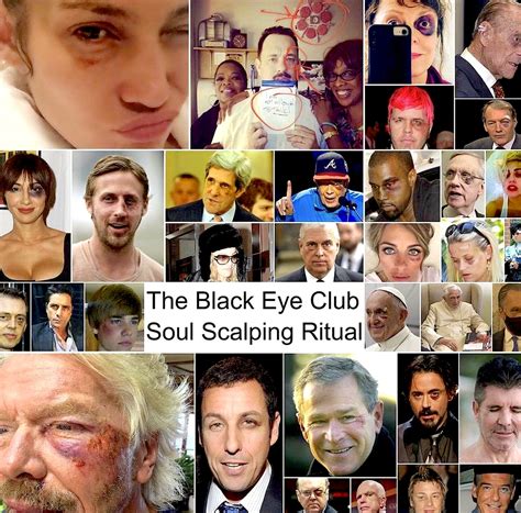 black eye conspiracy