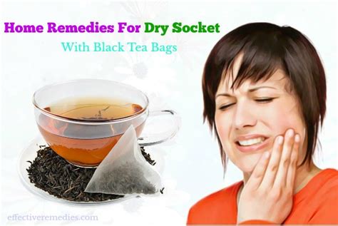 Black Tea Bag Dry Socket