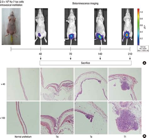 Bladder Cancer Mouse Models