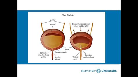 Bladder Problems in Women with MS