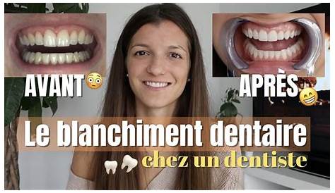 Blanchiment Dentaire Gouttiere Dentiste Prix Professionnel ⇒ Lyon Smil'art