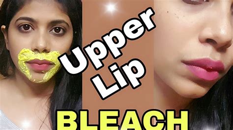 Bleaching Upper Lip Skin