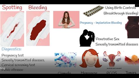 Understanding Vaginal Bleeding: Causes and Concerns About Bleeding from the Vagina