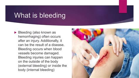 Bleeding Medical Terms