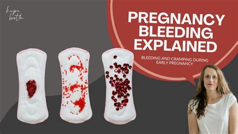Bleeding While Pregnant: What You Need to Know Immediately
