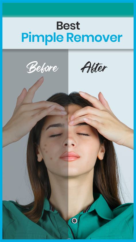 blemish remover iphone