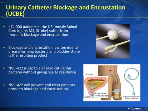 Blockage Of Catheter