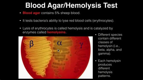 blood agar hemolysis test results