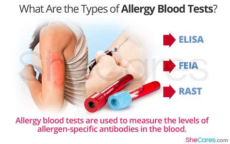 Uncover Hidden Dangers: What is a Blood Allergy Test?