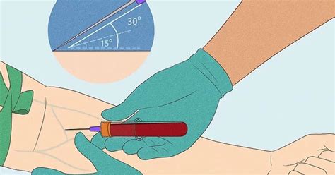 Blood Draw From Needle