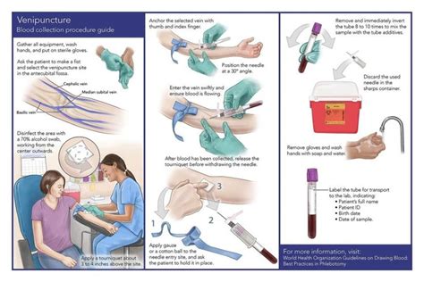 Blood draw procedure