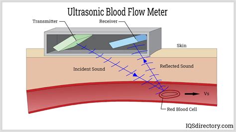 Blood Flow Meter Definition