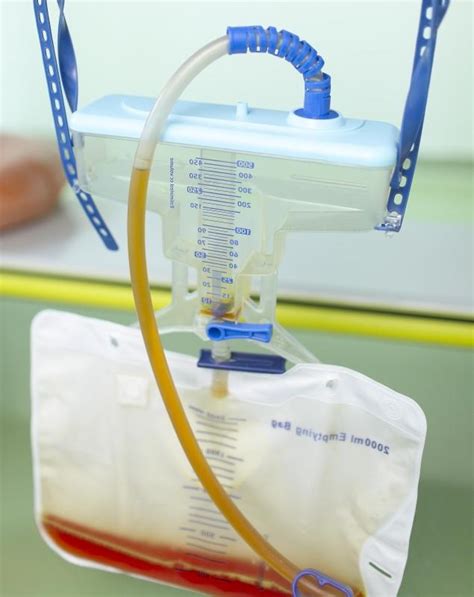 blood in catheter bag