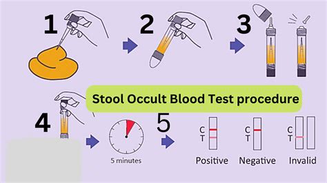 Understanding Blood in Stool Test: What Do the Results Mean for Your Health?