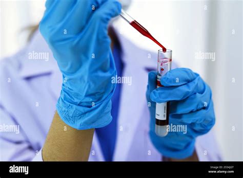 Blood Sample Collection For Dna Testing