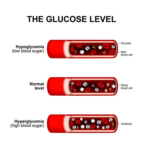blood sugar irregularities