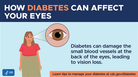 Blood Sugar Levels Eye Problems