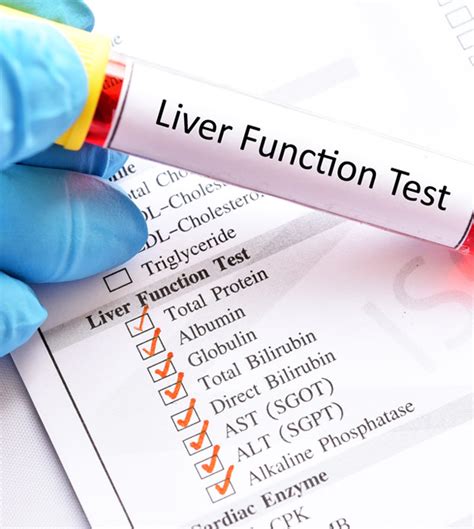 Blood Test For Liver Function Cost