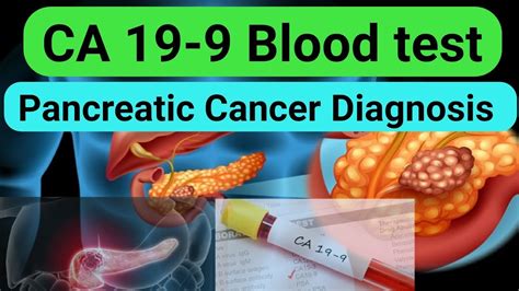 blood test for pancreatic cancer markers
