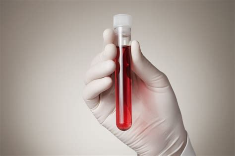 blood test for pfas chemicals
