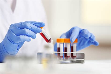 blood test image
