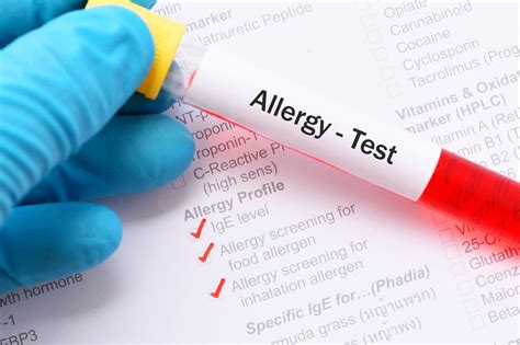 blood tests for allergies to metals