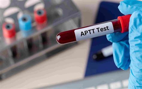 Understanding Your Blood Work: What Does a Prolonged aPTT Mean?