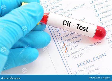 Understanding the Bloodwork CK Test: What You Need Know