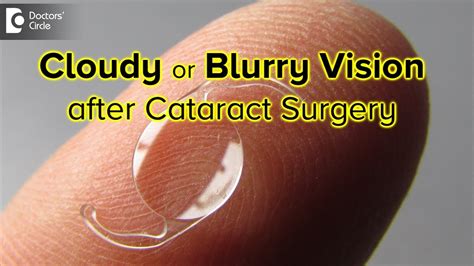 blurred vision after cataract surgery reasons