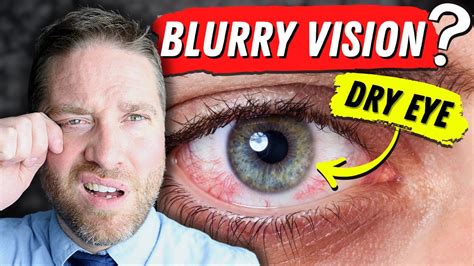 Blurred Vision In One Eye When Standing Up