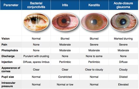 blurry eye medical term