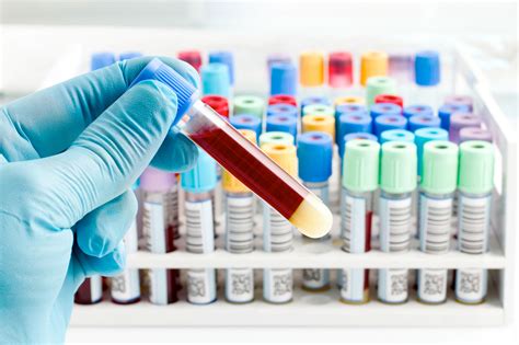 Lab Workup to diagnose diseases, Various Types of samples, Factors