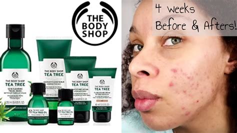 body shop products for acne