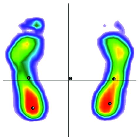 Body Weight Distribution Simulation