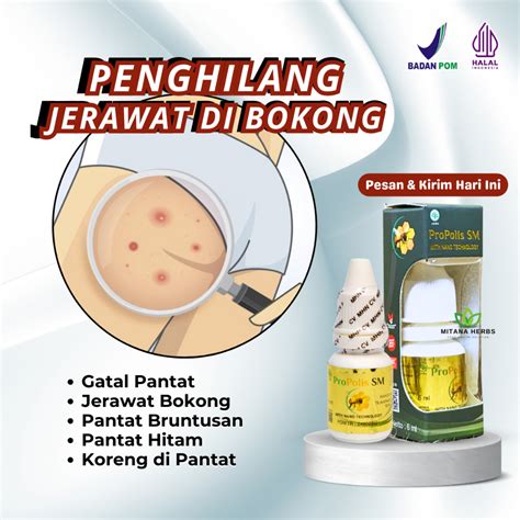 Jerawat di Bokong