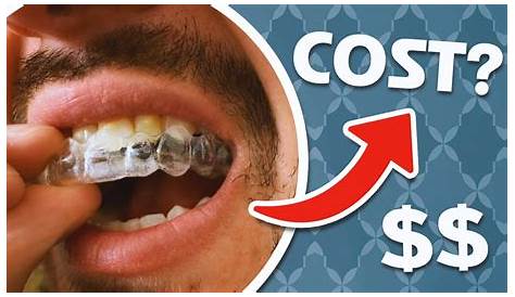 Orthodontic Retainers Types, Cost, Pros and Cons, Care