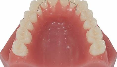 Maple Orthodontics Braces Aftercare