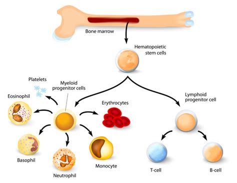 Bone Marrow Vs Bone Graft