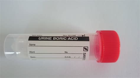 Urine Sample Pot (With Boric Acid) Medipost Sterilin Brand